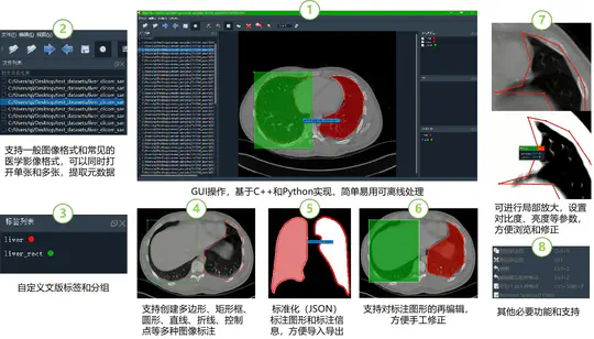 AI-Assisted Annotation